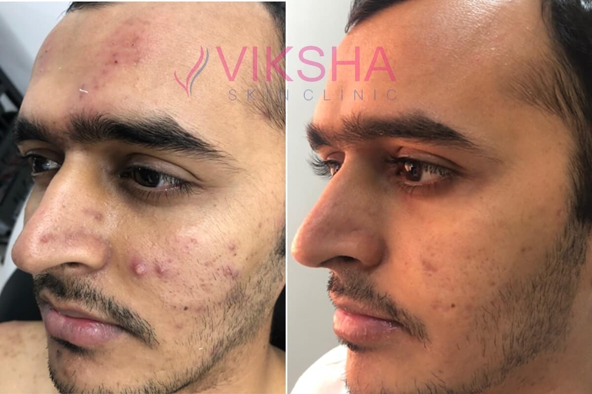 Viksha Skin Clinic In Ahmedabad